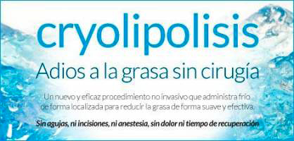 criolipolisis